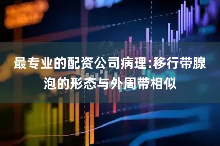 最专业的配资公司病理:移行带腺泡的形态与外周带相似